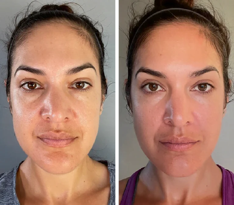 EMS Face Lifter – Tone, Tighten & Glow