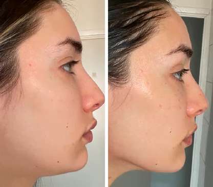 EMS Face Lifter – Tone, Tighten & Glow