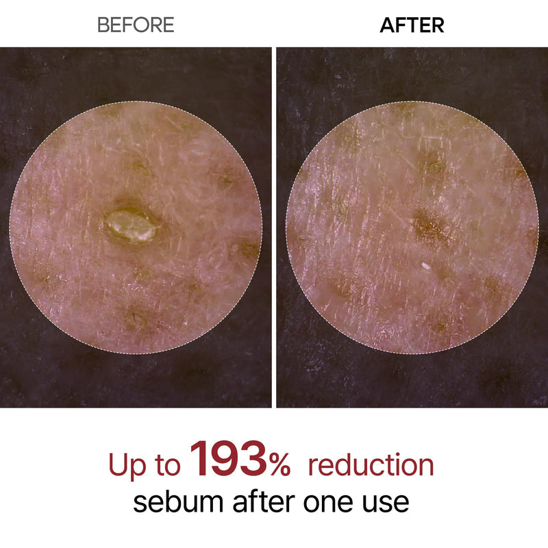 Dr. Melaxin Rice Peel Shot Ampoule Scrub For Dead Skin Cells, Blackheads Remover