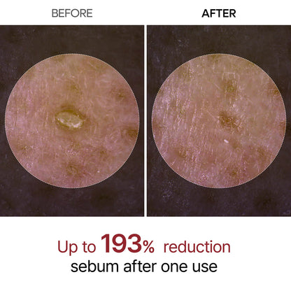 Dr. Melaxin Rice Peel Shot Ampoule Scrub For Dead Skin Cells, Blackheads Remover